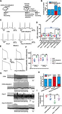 Pharmacological suppression of Nedd4-2 rescues the reduction of Kv11.1 channels in pathological cardiac hypertrophy